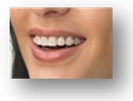 歯と同系色の装置